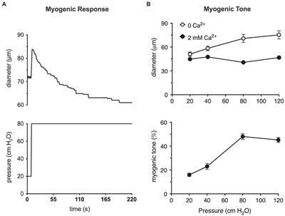 Myogenic Tone in Peripheral Resistance Arteries and Arterioles: The Pressure Is On!